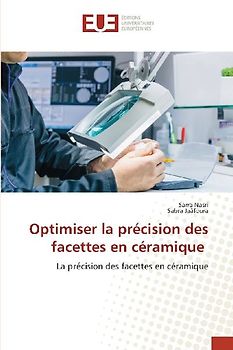 Optimiser la précision des facettes en céramique
