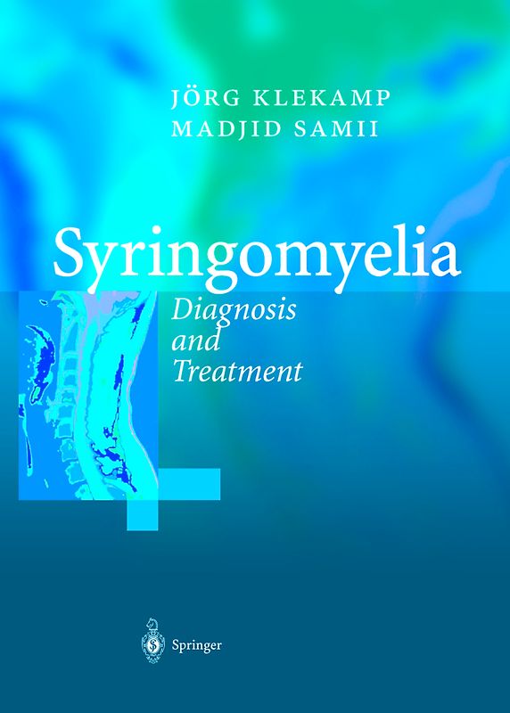Syringomyelia