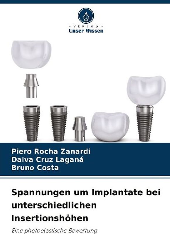 Spannungen um Implantate bei unterschiedlichen Insertionshöhen