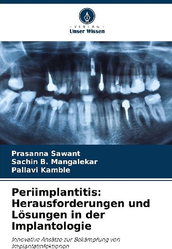Periimplantitis: Herausforderungen und Lösungen in der Implantologie