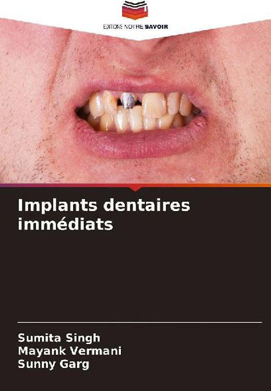 Implants dentaires immédiats