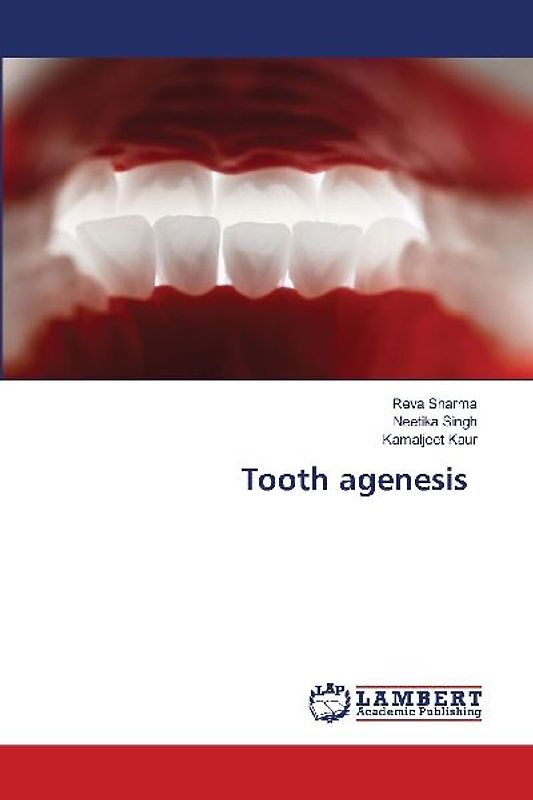 Tooth agenesis