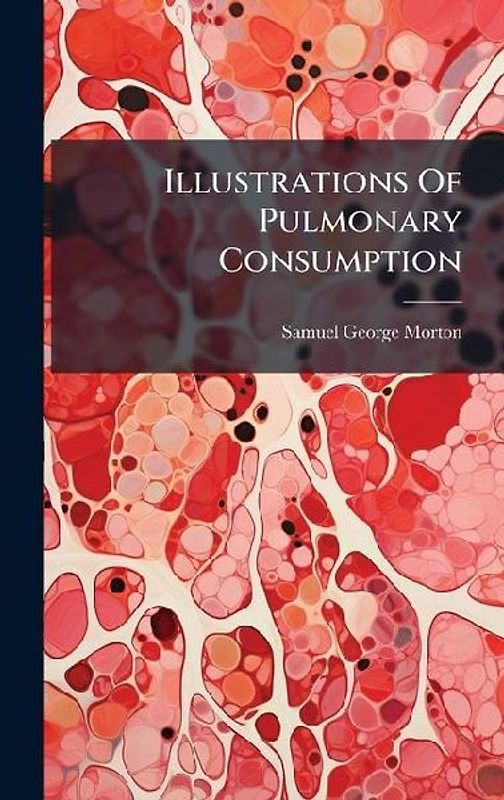 Illustrations Of Pulmonary Consumption