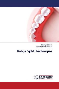 Ridge Split Technique
