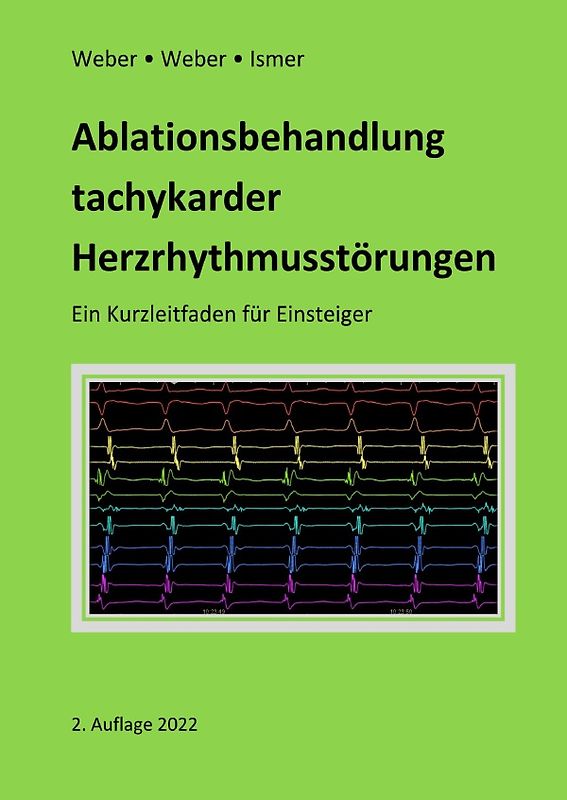 Ablationsbehandlung tachykarder Herzrhythmusstörungen