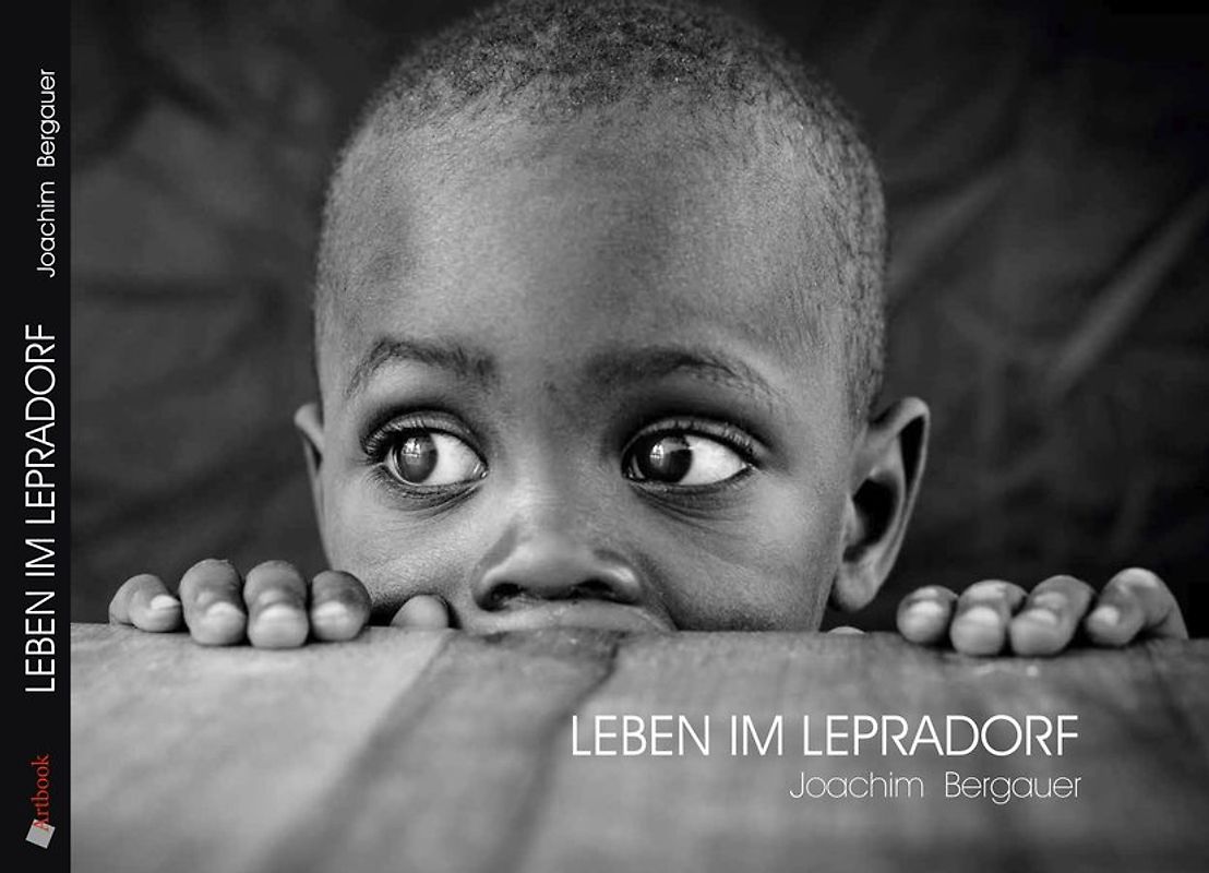 "Leben im Lepradorf"