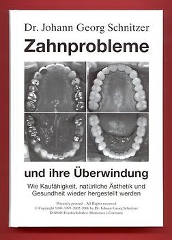 Zahnprobleme und ihre Überwindung