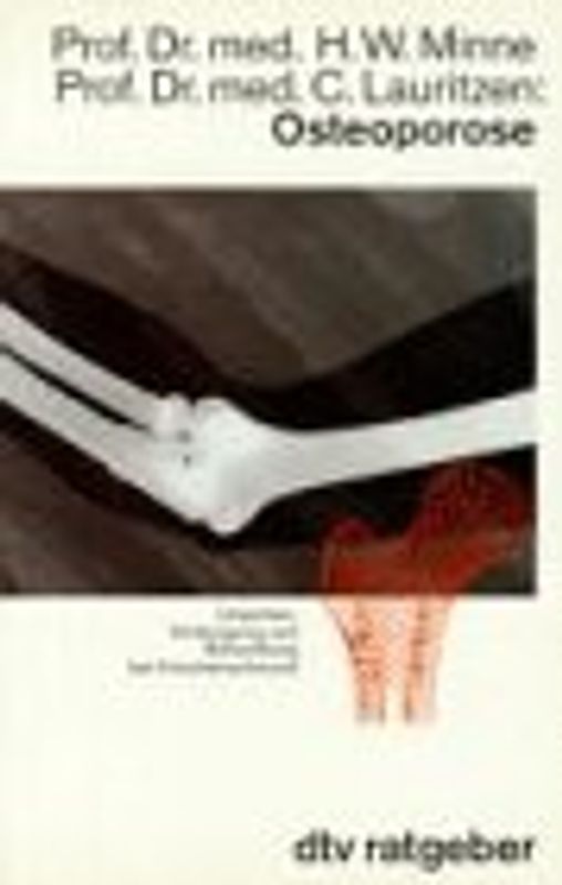 Osteoporose. Ursachen, Vorbeugung und Behandlung bei Knochenschwund