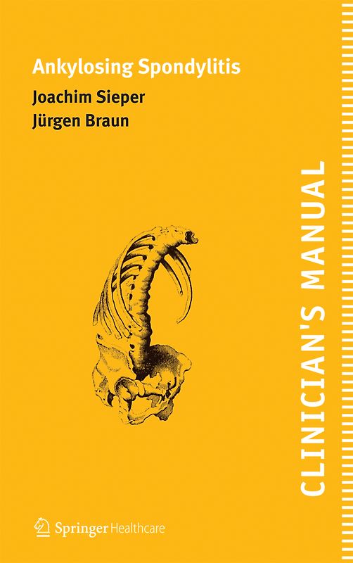 Clinician's Manual on Ankylosing Spondylitis