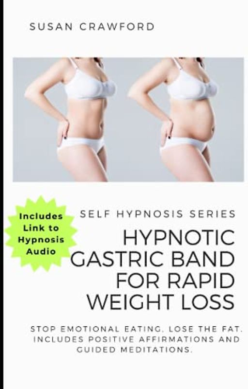 Hypnotic Gastric Band for Rapid Weight Loss: Weight loss hypnotherapy, extreme weight loss hypnosis guide, weight loss deep sleep hypnosis, extreme weight loss hypnosis and hypnotic gastric band