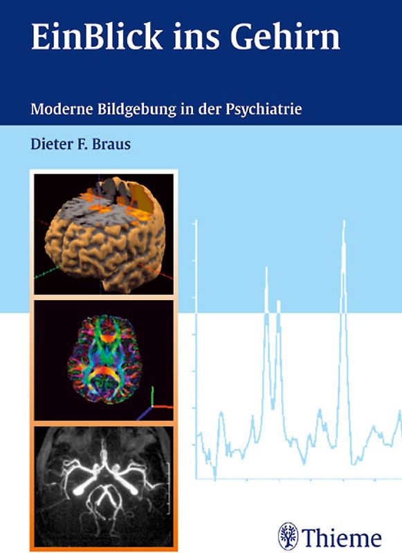 EinBlick ins Gehirn
