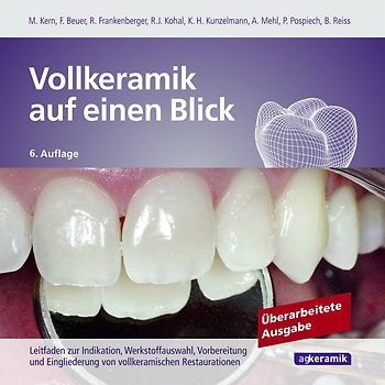 Vollkeramik auf einen Blick