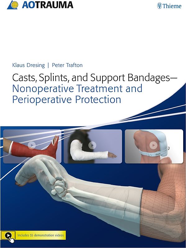Casts, Splints, and Support Bandages