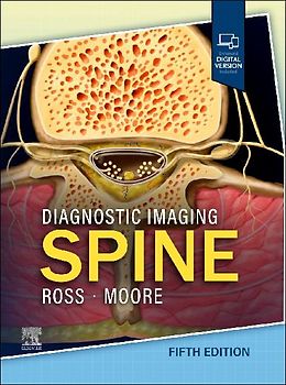 Diagnostic Imaging: Spine