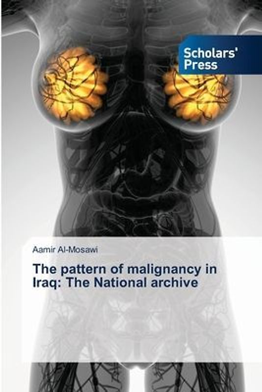 The pattern of malignancy in Iraq: The National archive