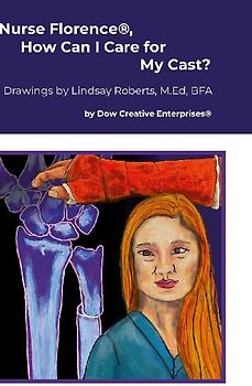 Nurse Florence®, How Can I Care for My Cast?