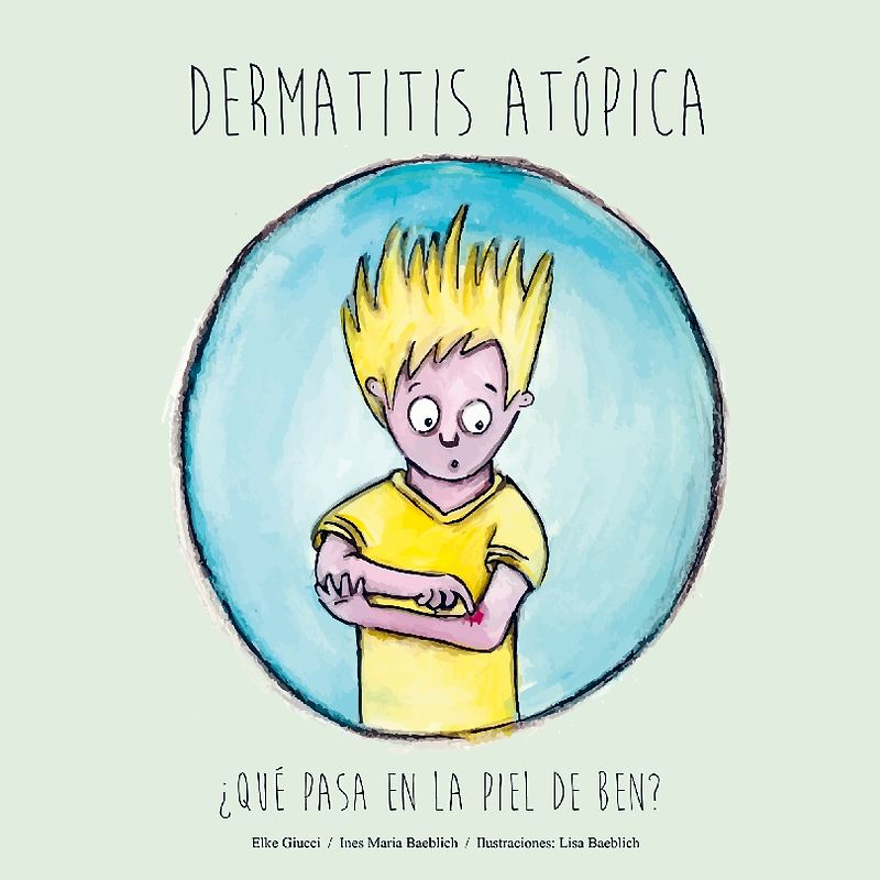 Dermatitis Atópica