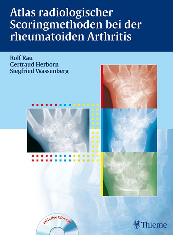 Atlas der Scoringmethoden bei der rheumatoiden Arthritis