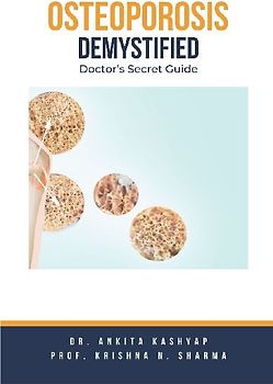 Osteoporosis Demystified