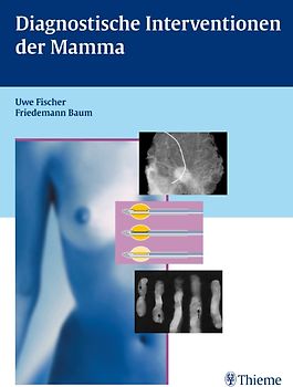 Diagnostische Interventionen der Mamma