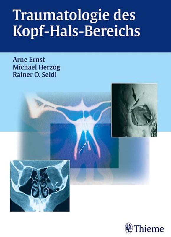 Traumatologie des Kopf-Hals-Bereichs