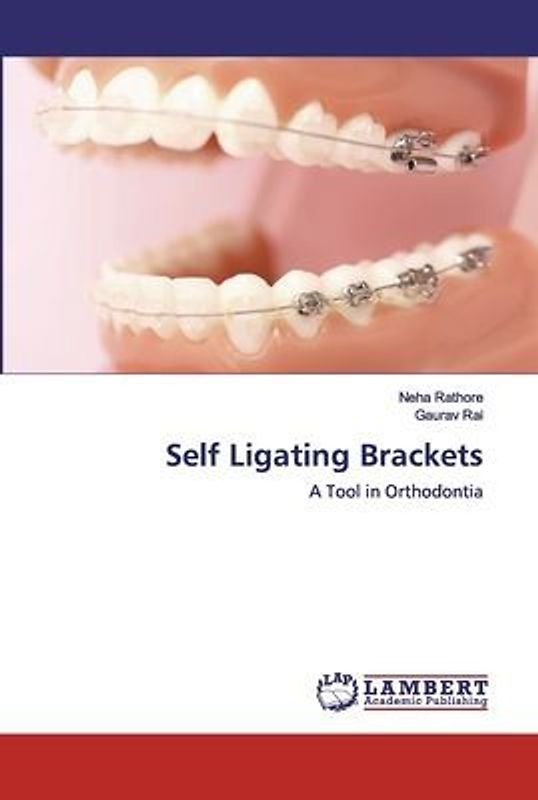 Self Ligating Brackets