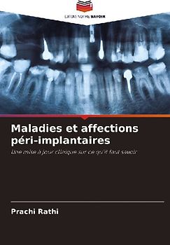 Maladies et affections péri-implantaires