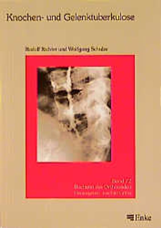 Knochen- und Gelenktuberkolose