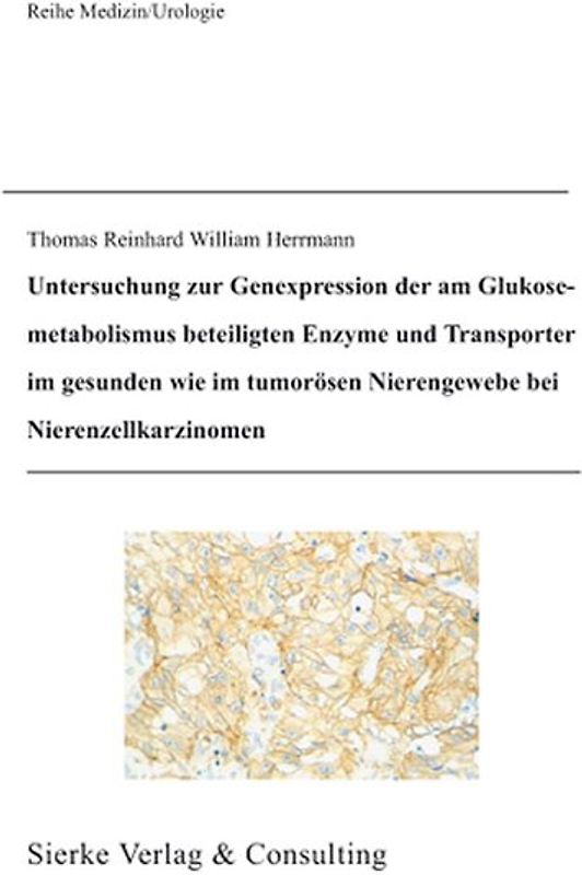 Untersuchung zur Genexpression der am Glukosemetabolismus beteiligten Enzyme und Tranporter im gesunden wie im tumorösen Nierengewebe bei Nierenzellkarzinomen