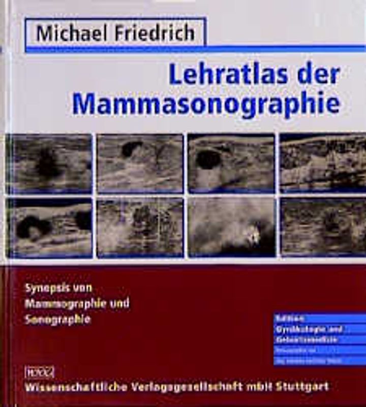 Lehratlas der Mammasonographie