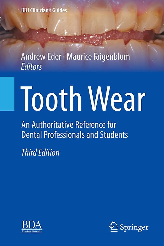 Tooth Wear