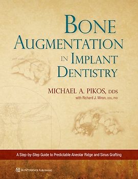 Bone Augmentation in Implant Dentistry