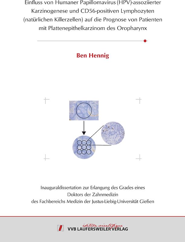 Einfluss von Humaner Papillomavirus (HPV)-assoziierter Karzinogenese und CD56-positiven Lymphozyten (natürlichen Killerzellen) auf die Prognose von Patienten mit Plattenepithelkarzinom des Oropharynx