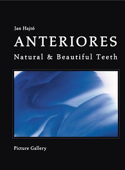 Anteriores - Natural & Beautiful Teeth Teil II