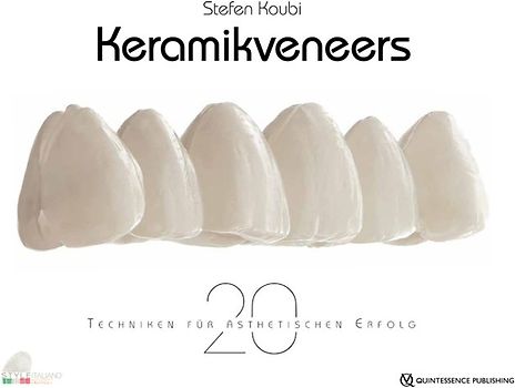 Keramikveneers