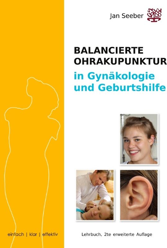 Ohrakupunktur in Gynäkologie und Geburtshilfe