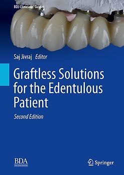 Graftless Solutions for the Edentulous Patient