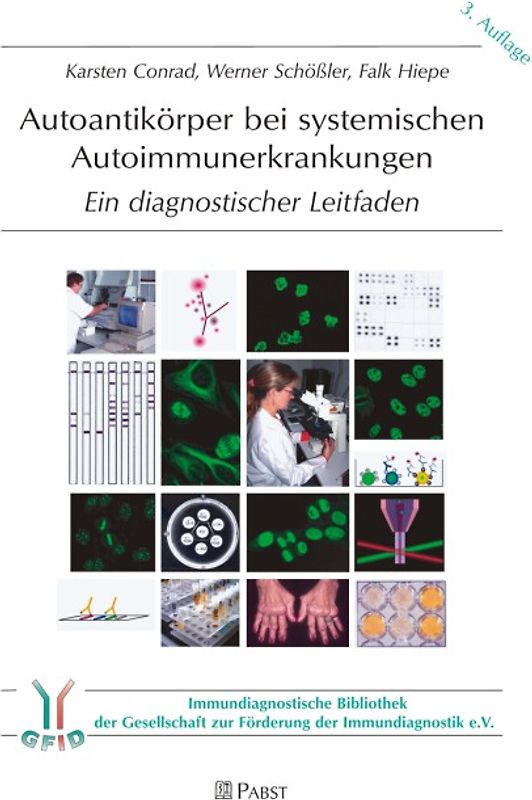 Autoantikörper bei systemischen Autoimmunerkrankungen