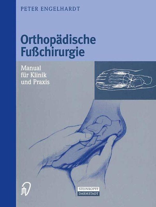 Orthopädische Fußchirurgie