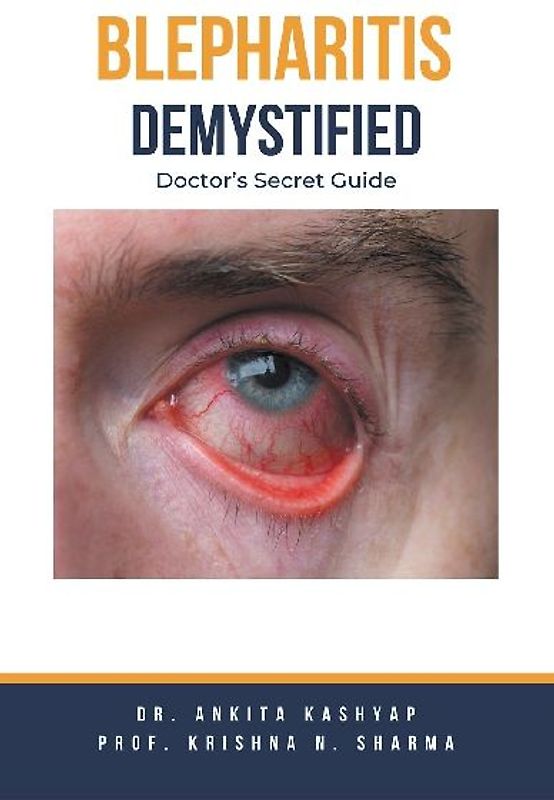 Blepharitis Demystified