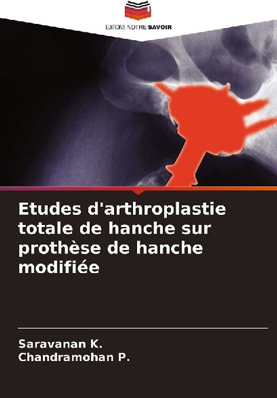 Etudes d'arthroplastie totale de hanche sur prothèse de hanche modifiée