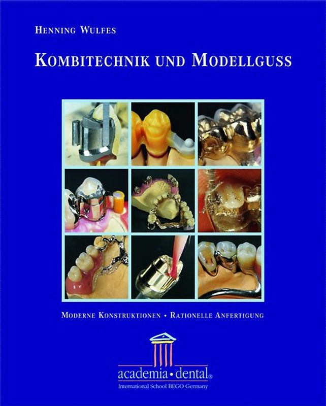 Kombitechnik und Modellguss: Ein Leitfaden