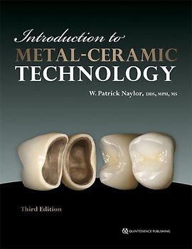 Introduction to Metal-Ceramic Technology