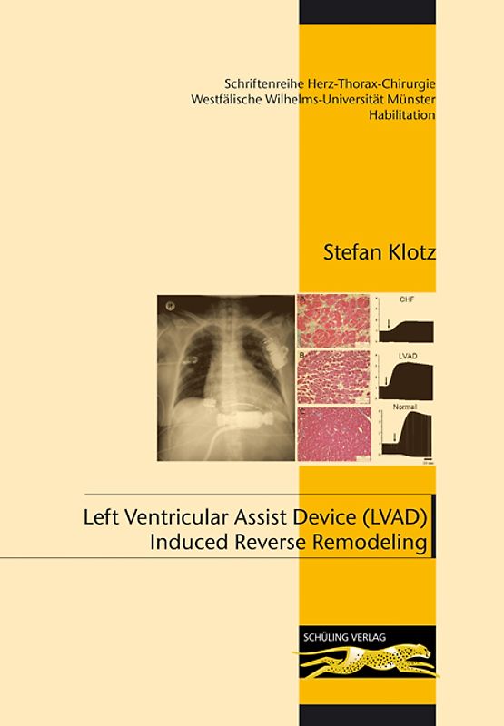 Left Ventricular Assist Device (LVAD) Induced Reverse Remodeling