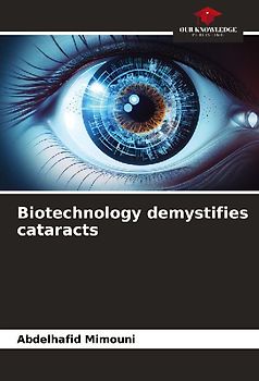 Biotechnology demystifies cataracts