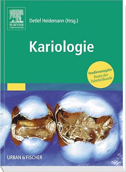 PDZ-Studienausgabe Grundlagen Paket. Endodontie, Implantologie, Kariologie,... / Kariologie und Füllungstherapie