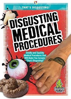 Disgusting Medical Procedures