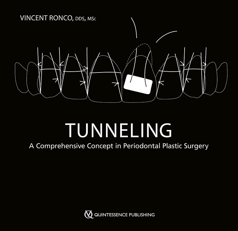Tunneling