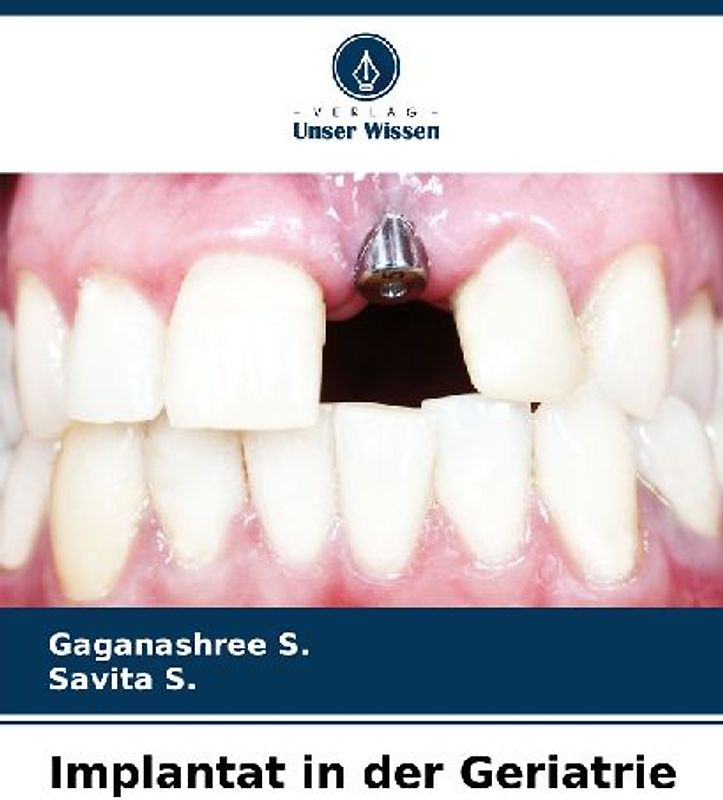 Implantat in der Geriatrie