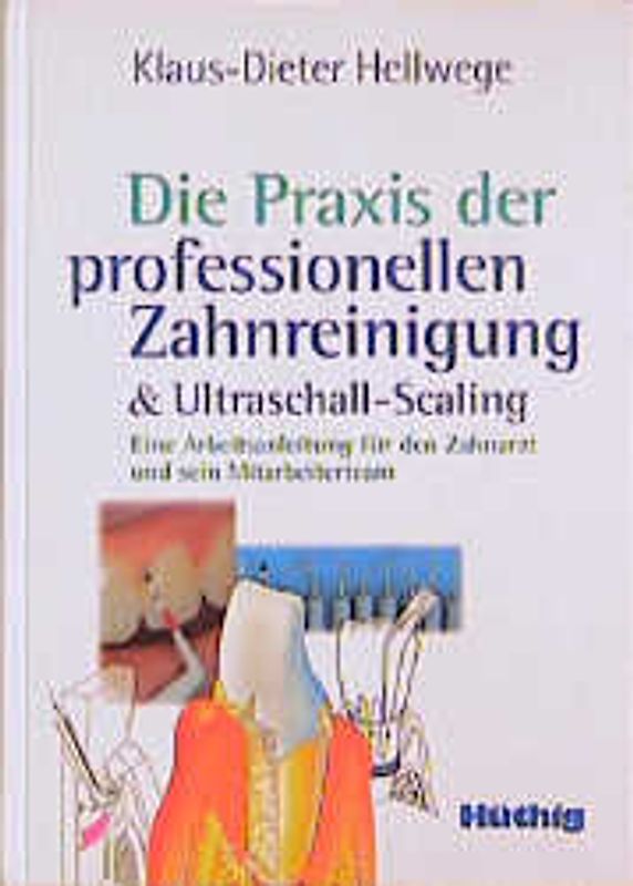 Die Praxis der professionellen Zahnreinigung & Ultraschall-Scaling. Eine Arbeitsanleitung für den Zahnarzt und sein Mitarbeiterteam